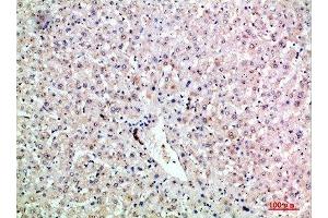 Immunohistochemical analysis of paraffin-embedded human-liver, antibody was diluted at 1:200 (LTB anticorps  (AA 41-90))