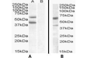 Western Blotting (WB) image for anti-Diacylglycerol O-Acyltransferase 2 (DGAT2) (Internal Region) antibody (ABIN2465597) (DGAT2 anticorps  (Internal Region))
