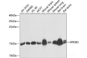 Western blot analysis of extracts of various cell lines using PPP3R1 Polyclonal Antibody at dilution of 1:1000. (PPP3R1 anticorps)