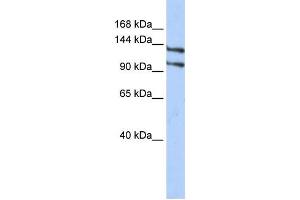 Western Blotting (WB) image for anti-RNA Binding Motif Protein 5 (RBM5) antibody (ABIN2458330) (RBM5 anticorps)