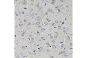 Immunohistochemistry of paraffin-embedded rat brain using AMPD1 antibody (ABIN5995393) (40x lens). (AMPD1 anticorps)