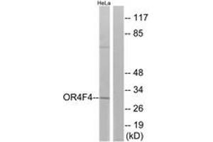 Western Blotting (WB) image for anti-Olfactory Receptor, Family 4, Subfamily F, Member 4 (OR4F4) (AA 256-305) antibody (ABIN2891009) (OR4F4 anticorps  (AA 256-305))
