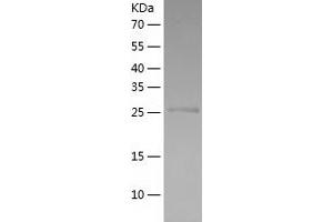 Western Blotting (WB) image for Integrin alpha M (ITGAM) (AA 567-825) protein (His tag) (ABIN7123468)