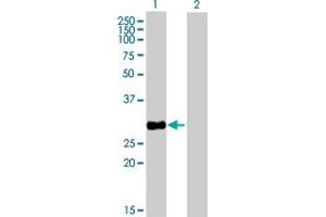 Western Blot analysis of HSD17B8 expression in transfected 293T cell line by HSD17B8 MaxPab polyclonal antibody. (HSD17B8 anticorps  (AA 1-261))