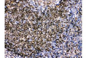 Anti- Pax2 Picoband antibody,IHC(P) IHC(P): Human Tonsil Tissue