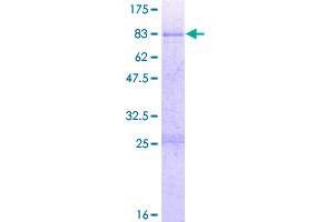Image no. 1 for Actin Binding LIM Protein Family, Member 3 (ABLIM3) (AA 1-544) protein (GST tag) (ABIN1305542)
