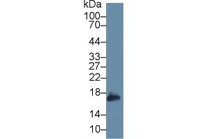 Detection of PRDX5 in Mouse Liver lysate using Polyclonal Antibody to Peroxiredoxin 5 (PRDX5)