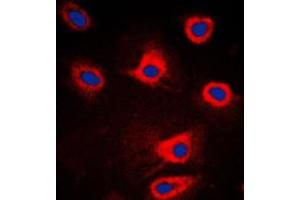 Immunofluorescent analysis of PERK staining in HeLa cells. (PERK anticorps  (N-Term))
