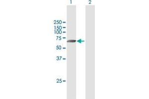Western Blot analysis of TMPRSS6 expression in transfected 293T cell line by TMPRSS6 MaxPab polyclonal antibody.