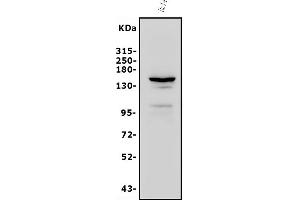 Western blot analysis of FLT1 using anti-FLT1 antibody (ABIN7601014).