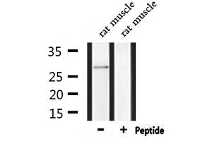 Western blot analysis of extracts from rat muscle, using MPZ Antibody.