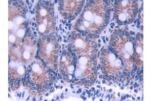 DAB staining on IHC-P; Samples: Rat Small intestine Tissue