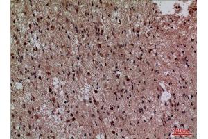 Immunohistochemistry (IHC) analysis of paraffin-embedded Human Brain, antibody was diluted at 1:100.