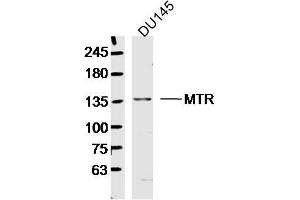 DU145 lysates probed with MTR Polyclonal Antibody, Unconjugated  at 1:300 dilution and 4˚C overnight incubation. (MTR anticorps  (AA 1001-1100))