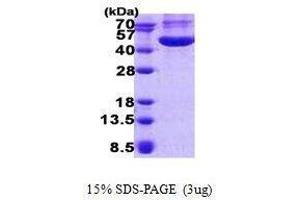 Figure annotation denotes ug of protein loaded and % gel used. (CHI3L1 Protéine)