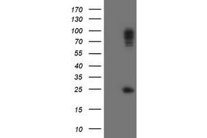 Image no. 1 for anti-Spastic Paraplegia 7 (SPG7) (AA 300-573) antibody (ABIN1491370) (SPG7 anticorps  (AA 300-573))