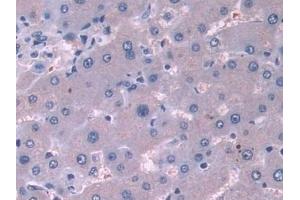 Detection of CTTN in Mouse Liver Tissue using Polyclonal Antibody to Cortactin (CTTN)