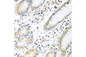 Immunohistochemistry of paraffin-embedded human stomach using IL5 antibody (ABIN5975164) at dilution of 1/100 (40x lens). (IL-5 anticorps)