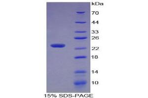 SDS-PAGE (SDS) image for Stathmin 1 (STMN1) (AA 2-149) protein (His tag) (ABIN1879208) (Stathmin 1 Protein (STMN1) (AA 2-149) (His tag))