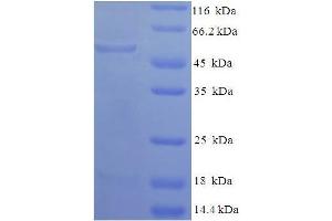 SDS-PAGE (SDS) image for Glycerol-3-Phosphate Dehydrogenase 1 (Soluble) (GPD1) (AA 1-349), (full length) protein (His-SUMO Tag) (ABIN5709607)