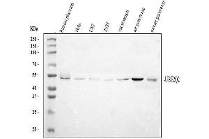 Western blot analysis of UBE2Q2 using anti-UBE2Q2 antibody (ABIN3043953). (UBE2Q2 anticorps  (N-Term))