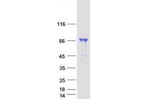Validation with Western Blot