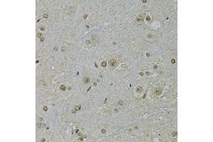 Immunohistochemistry of paraffin-embedded rat spinal cord using NLK antibody (ABIN1873910) at dilution of 1:100 (40x lens). (Nemo-Like Kinase anticorps)