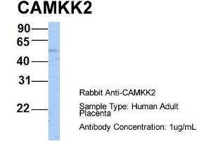 Host: Rabbit  Target Name: CAMKK2  Sample Tissue: Human Adult Placenta  Antibody Dilution: 1. (CAMKK2 anticorps  (N-Term))
