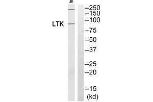 Western blot analysis of extracts from Jurkat cells, using LTK antibody. (LTK anticorps)