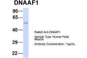 Host: Rabbit  Target Name: DNAAF1  Sample Tissue: Human Fetal Muscle  Antibody Dilution: 1.