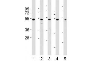 Western blot testing of NFKBIE antibody at 1:2000 dilution. (NFKBIE anticorps  (N-Term))