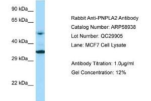 Western Blotting (WB) image for anti-Patatin-Like phospholipase Domain Containing 2 (PNPLA2) (Middle Region) antibody (ABIN2787884) (PNPLA2 anticorps  (Middle Region))