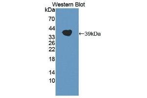 Western Blotting (WB) image for anti-Apolipoprotein A (APOA) (AA 1719-2038) antibody (ABIN1869010) (LPA anticorps  (AA 1719-2038))