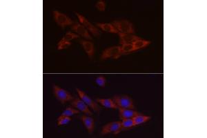 Immunofluorescence analysis of PC-12 cells using Bcl-2 Mouse mAb (ABIN7265809) at dilution of 1:100 (40x lens). (Bcl-2 anticorps)