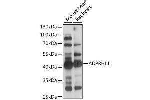 Western blot analysis of extracts of various cell lines, using ADPRHL1 antibody (ABIN6292800) at 1:1000 dilution.