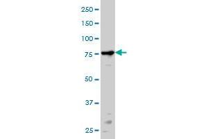 PRKCA monoclonal antibody (M01), clone 2F11 Western Blot analysis of PRKCA expression in HeLa .
