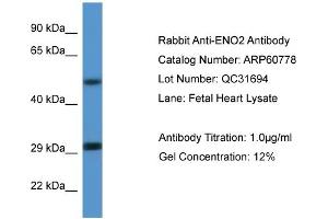 Western Blotting (WB) image for anti-Enolase 2 (Gamma, Neuronal) (ENO2) (N-Term) antibody (ABIN786270) (ENO2/NSE anticorps  (N-Term))