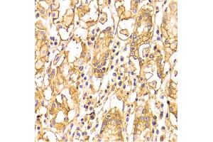 Immunohistochemistry of paraffin-embedded human stomach using BSG Antibody (ABIN5970747) at dilution of 1/100 (40x lens).