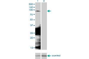 Western blot analysis of CTNNB1 over-expressed 293 cell line, cotransfected with CTNNB1 Validated Chimera RNAi (Lane 2) or non-transfected control (Lane 1).