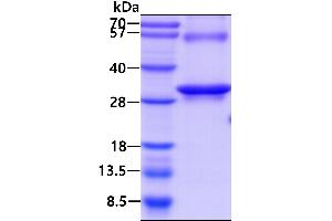 SDS-PAGE (SDS) image for RAB27A, Member RAS Oncogene Family (RAB27A) (AA 1-221) protein (His tag) (ABIN666995)