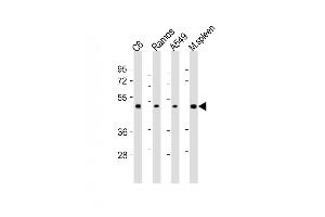 All lanes : Anti-CSK Antibody (N-term) at 1:2000 dilution Lane 1: C6 whole cell lysates Lane 2: Ramos whole cell lysates Lane 3: A549 whole cell lysates Lane 4: mouse spleen lysates Lysates/proteins at 20 μg per lane. (CSK anticorps  (N-Term))