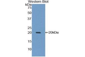 Western Blotting (WB) image for anti-Matrix Metallopeptidase 9 (Gelatinase B, 92kDa Gelatinase, 92kDa Type IV Collagenase) (MMP9) (AA 225-390) antibody (ABIN1173112)