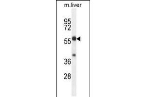 Western blot analysis in mouse liver tissue lysates (35ug/lane). (TBCCD1 anticorps  (C-Term))