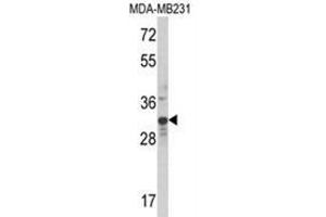 Western blot analysis of MLX Antibody (Center) in MDA-MB231 cell line lysates (35ug/lane). (MLX anticorps  (Middle Region))