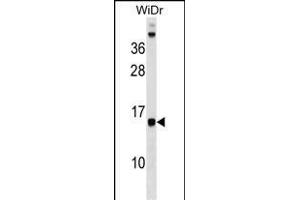 DAD1 Antibody (C-term) (ABIN1537513 and ABIN2849048) western blot analysis in WiDr cell line lysates (35 μg/lane). (DAD1 anticorps  (C-Term))