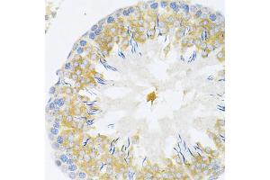 Immunohistochemistry of paraffin-embedded rat testis using TAPBP Antibody (ABIN1875423) at dilution of 1:200 (40x lens). (TAPBP anticorps)