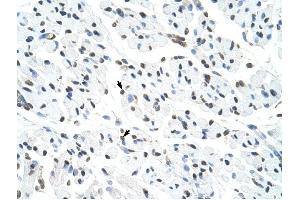 Matrin 3 antibody was used for immunohistochemistry at a concentration of 4-8 ug/ml to stain Skeletal muscle cells (arrows) in Human Muscle.