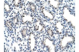 THOC4 antibody was used for immunohistochemistry at a concentration of 4-8 ug/ml to stain Alveolar cells (arrows) in Human Lung. (THO Complex 4 anticorps  (N-Term))