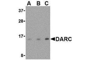 Western blot analysis of DARC in PC-3 cell lysate with AP30274PU-N DARC antibody at (A) 0. (DARC anticorps  (N-Term))