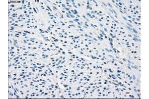 Immunohistochemical staining of paraffin-embedded endometrium tissue using anti-SLC2A5mouse monoclonal antibody. (SLC2A5 anticorps)
